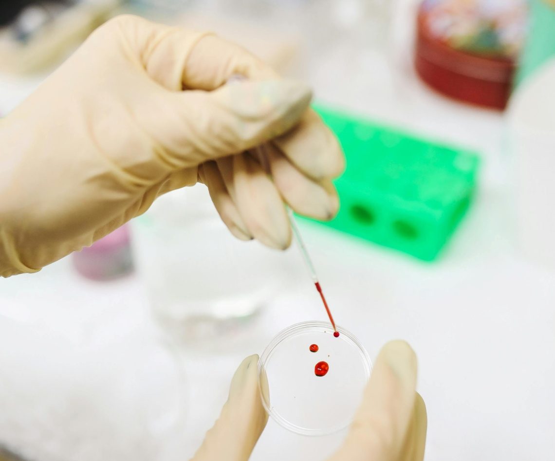 cord blood benefits