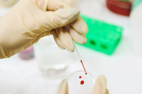 cord blood benefits