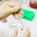 cord blood benefits