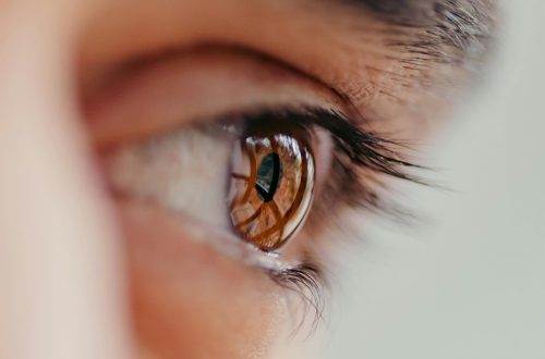 eyecare