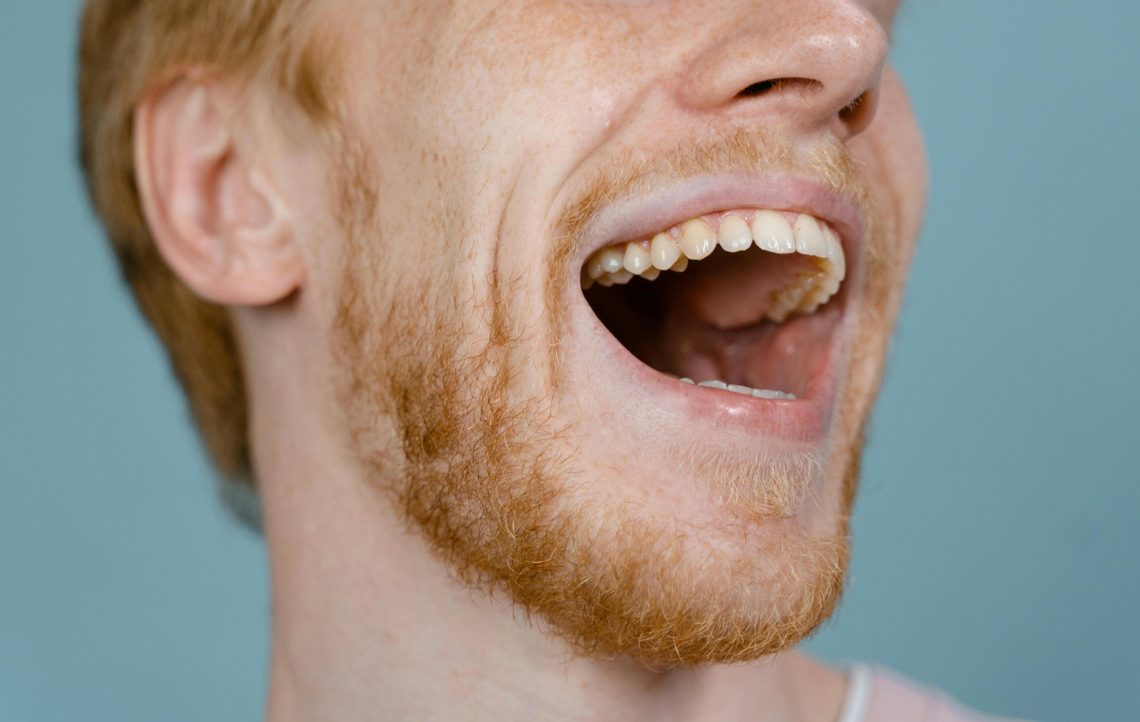 How to Fix a Cracked Tooth