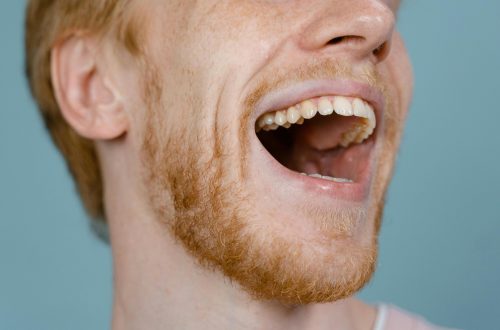 How to Fix a Cracked Tooth