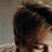 hair transplant